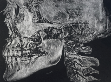 Image: A section of the front cover of “Genocide House”, which features a skeleton's skull. The skull illustration is "Record of Wear (detail)" by Devon Stackonis, 2021. Mezzotint intaglio print on Zerkall paper. Images by Devon Stackonis. All images courtesy Bridge Books.